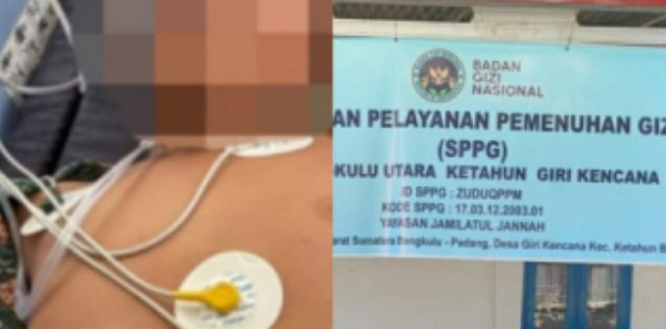 Teka Teki Kematian Siswa MIN 2 Ketahun, Dikaitkan Dengan Keracunan MBG
